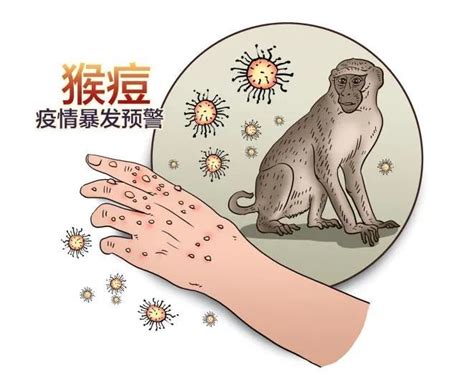 猴痘病毒的传播途径及症状，这种病的症状实在是过于恶心