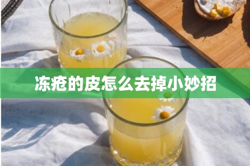 冻疮的皮怎么去掉小妙招