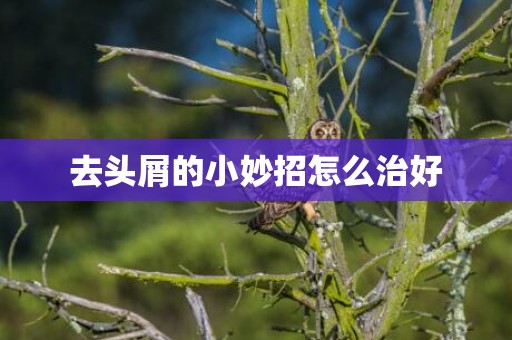 去头屑的小妙招怎么治好