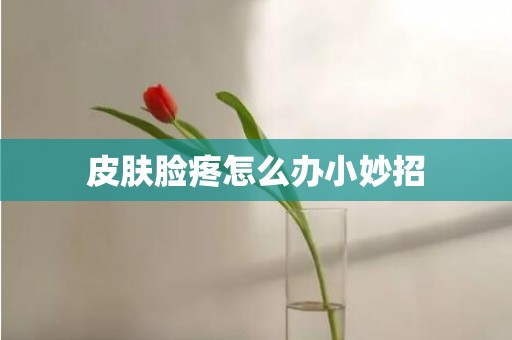皮肤脸疼怎么办小妙招