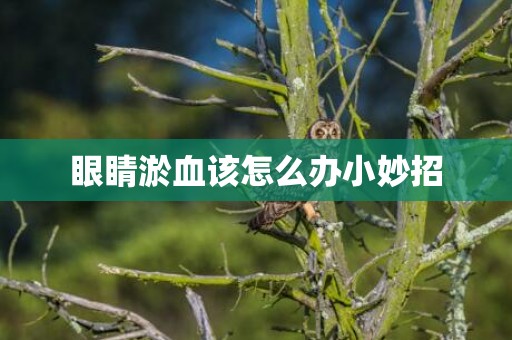 眼睛淤血该怎么办小妙招