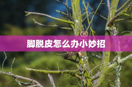 脚脱皮怎么办小妙招