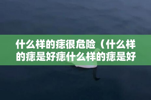 什么样的痣很危险（什么样的痣是好痣什么样的痣是好痣图片）