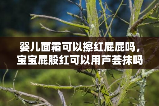 婴儿面霜可以擦红屁屁吗，宝宝屁股红可以用芦荟抹吗